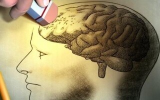 Доктор указывает на опасность затруднения вен мозга