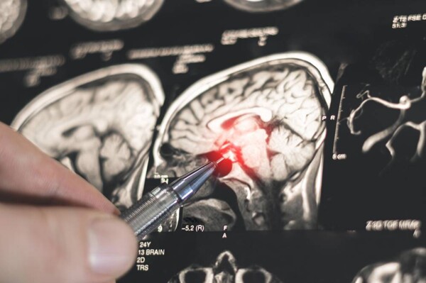 Russian Researchers Discover Role of CRYAB Protein in Diabetes